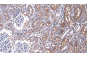 Detection of CD164 in Rat Kidney Tissue using Polyclonal Antibody to Cluster Of Differentiation 164 (CD164) (CD164 anticorps  (AA 24-160))