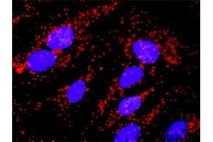 Proximity Ligation Analysis of protein-protein interactions between TP53 and BCR.