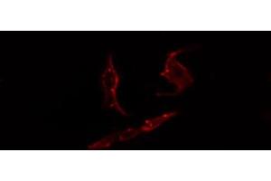 ABIN6274444 staining COLO205 cells by IF/ICC. (PARD3 anticorps  (C-Term))