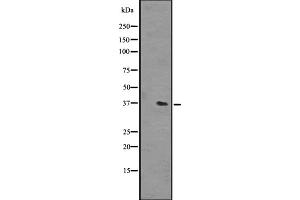 Western blot analysis of OR51L1 expression in NCI-H292 cell line lysates ,The lane on the left is treated with the antigen-specific peptide. (OR51L1 anticorps  (Internal Region))