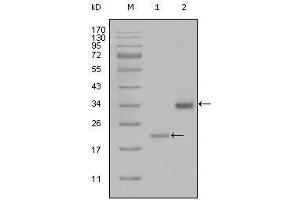 Western blot analysis using LPA mouse mAb against truncated LPA-His recombinant protein (1) and truncated Trx-LPA(aa4330-4521) recombinant protein (2). (LPA anticorps)