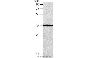 Western blot analysis of Human fetal brain tissue, using AASDHPPT Polyclonal Antibody at dilution of 1:650 (AASDHPPT anticorps)