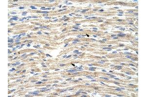 anti-CDKN2A Interacting Protein (CDKN2AIP) (C-Term) antibody