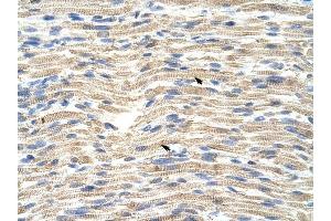 CARF antibody was used for immunohistochemistry at a concentration of 4-8 ug/ml to stain Skeletal muscle cells (arrows) in Human Muscle. (CDKN2AIP anticorps  (C-Term))