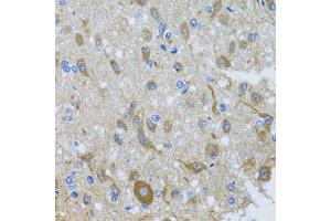 Immunohistochemistry of paraffin-embedded rat brain using DYNC1I1 antibody. (DYNC1I1 anticorps)