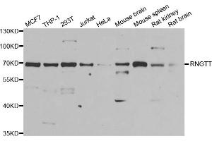 Western blot analysis of extracts of various cell lines, using RNGTT antibody (ABIN5973831) at 1/1000 dilution. (RNGTT anticorps)
