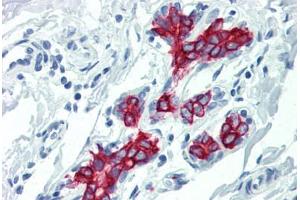 Human Breast (formalin-fixed, paraffin-embedded) stained with KRT19 antibody ABIN396943 at 10 ug/ml followed by biotinylated anti-mouse IgG secondary antibody ABIN481714, alkaline phosphatase-streptavidin and chromogen. (Cytokeratin 19 anticorps)
