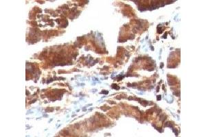 Formalin-fixed, paraffin-embedded human gallbladder stained with TOP1MT antibody (TOP1MT/488). (TOP1MT anticorps)