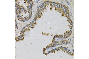 Immunohistochemistry of paraffin-embedded human prostate using EFNA1 Antibody (ABIN1876529) at dilution of 1:100 (40x lens).