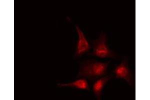 ABIN6267657 staining HeLa by IF/ICC. (NFKBIB anticorps  (pSer19))