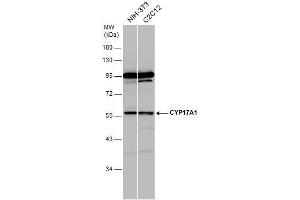 WB Image Various whole cell extracts (30 μg) were separated by 10% SDS-PAGE, and the membrane was blotted with CYP17A1 antibody [N1C2] , diluted at 1:1000. (CYP17A1 anticorps  (Center))
