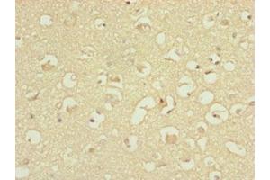 Immunohistochemistry of paraffin-embedded human brain tissue using ABIN7144845 at dilution of 1:100