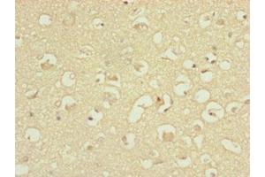 Immunohistochemistry of paraffin-embedded human brain tissue using ABIN7144845 at dilution of 1:100 (ATP5H anticorps  (AA 1-161))
