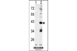 Western blot analysis of CTDSP1 using rabbit polyclonal p38 beta Antibody using 293 cell lysates (2 ug/lane) either nontransfected (Lane 1) or transiently transfected with the CTDSP1 gene (Lane 2). (MAPK11 anticorps  (AA 133-161))