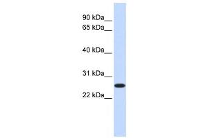 Western Blotting (WB) image for anti-CTD Nuclear Envelope Phosphatase 1a (CTDNEP1A) antibody (ABIN2459072)