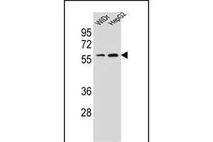 HOXA10 Antibody (Center) (ABIN654234 and ABIN2844067) western blot analysis in WiDr,HepG2 cell line lysates (35 μg/lane). (HOXA10 anticorps  (AA 244-271))
