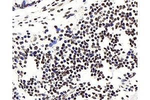 Immunohistochemistry analysis of paraffin-embedded human colon using NFKBIB Polyclonal Antibody at dilution of 1:300.