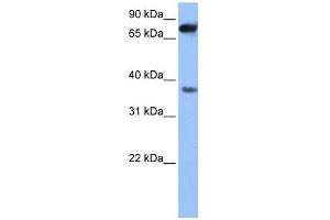 ZCCHC12 antibody used at 1 ug/ml to detect target protein. (ZCCHC12 anticorps  (N-Term))