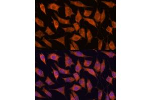 Immunofluorescence analysis of L929 cells using KIF13A antibody (ABIN7268122) at dilution of 1:100.