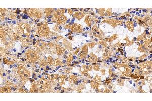 Detection of IL13Ra2 in Human Stomach Tissue using Polyclonal Antibody to Interleukin 13 Receptor Alpha 2 (IL13Ra2)