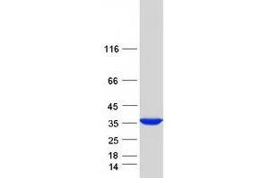 Validation with Western Blot