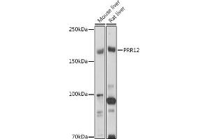 Western blot analysis of extracts of various cell lines, using PRR12 antibody (ABIN7269553) at 1:1000 dilution. (Proline Rich 12 anticorps)
