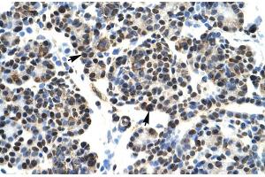 Human Pancrease lysate (HOXB5 anticorps  (N-Term))