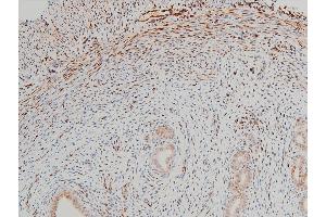 ABIN6267443 at 1/100 staining rat uterine tissue sections by IHC-P.