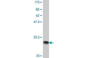 Western Blot detection against Immunogen (32.
