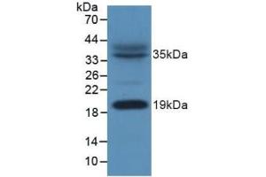 Detection of ACP in Mouse Heart Tissue using Polyclonal Antibody to Acyl Carrier Protein, Mitochondrial (ACP)