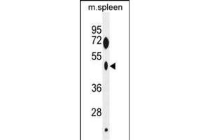 ZNF385C Antibody (N-term) (ABIN655429 and ABIN2844966) western blot analysis in mouse spleen tissue lysates (35 μg/lane). (ZNF385C anticorps  (N-Term))