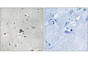 Immunohistochemistry analysis of paraffin-embedded human brain tissue, using Claudin 4 (Ab-208) Antibody.