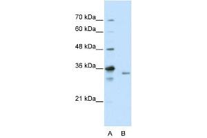 EXOSC3 antibody used at 2. (EXOSC3 anticorps  (C-Term))