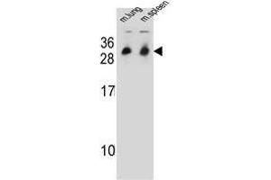 Western blot analysis in mouse lung/spleen tissue lysates (35ug/lane) using CYB561D1 Antibody . (CYB561D1 anticorps  (C-Term))