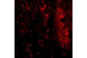 Immunofluorescence of IL-33 in human lymph node tissue with AP30426PU-N IL-33 antibody at 20 μg/ml.