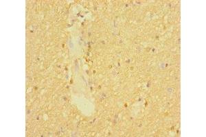Immunohistochemistry of paraffin-embedded human brain tissue using ABIN7170007 at dilution of 1:100 (SLC6A7 anticorps  (AA 557-636))