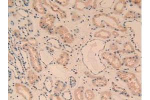 IHC-P analysis of Human Kidney Tissue, with DAB staining. (C1QA anticorps  (AA 28-245))