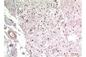 Immunohistochemistry (IHC) analysis of paraffin-embedded Human Colon, antibody was diluted at 1:100.