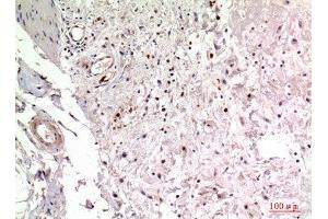 Immunohistochemistry (IHC) analysis of paraffin-embedded Human Colon, antibody was diluted at 1:100. (ITGA2 anticorps  (Internal Region))