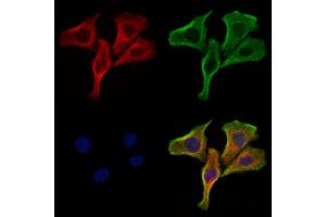 ABIN6266273 and ABIN6277461 staining Hela cells by IF/ICC.