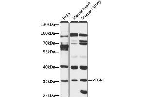 Western blot analysis of extracts of various cell lines, using PTGR1 antibody (ABIN6129622, ABIN6146411, ABIN6146412 and ABIN6220671) at 1:3000 dilution. (PTGR1 anticorps  (AA 1-115))