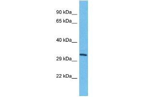 Host: Rabbit Target Name: TMEM202 Sample Type: HepG2 Whole Cell lysates Antibody Dilution: 1. (TMEM202 anticorps  (C-Term))