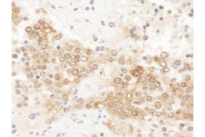 Immunohistochemistry (IHC) image for anti-Chloride Channel, Nucleotide-Sensitive, 1A (CLNS1A) (AA 187-237) antibody (ABIN7455042) (CLNS1A anticorps  (AA 187-237))