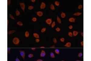 Immunofluorescence analysis of L929 cells using ZCCHC3 Polyclonal Antibody at dilution of 1:100. (ZCCHC3 anticorps)