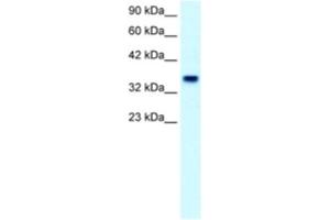 Western Blotting (WB) image for anti-Forkhead Box F1 (FOXF1) antibody (ABIN2460416) (FOXF1 anticorps)