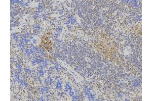 ABIN6275021 at 1/100 staining Human lymph node tissue by IHC-P. (ST6GAL1 anticorps  (Internal Region))