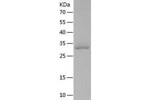 Western Blotting (WB) image for Spindle and Kinetochore Associated Complex Subunit 1 (SKA1) (AA 1-255) protein (His tag) (ABIN7125191)