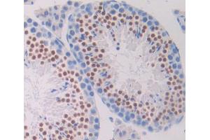 Used in DAB staining on fromalin fixed paraffin- embedded testis tissue (DTYMK anticorps  (AA 43-190))