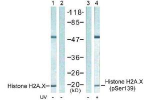 Image no. 1 for anti-H2A Histone Family, Member X (H2AFX) (pSer139) antibody (ABIN197033) (H2AFX anticorps  (pSer139))