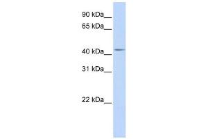 WB Suggested Anti-DENND1B Antibody Titration: 0. (DENND1B anticorps  (Middle Region))